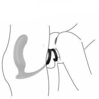 Remote Control 3-In-1 Prostate Penis Stimulator